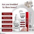 thumbnail image 5 of 15ml Fungi Nail Treatment Liquid Fast-Acting Nail Repair Strengthening Liquid Nails Care Supplies, 5 of 5