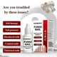 thumbnail image 5 of 15ml Fungi Nail Treatment Liquid Fast-Acting Nail Repair Strengthening Liquid Nails Care Supplies, 5 of 5