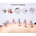 thumbnail image 3 of Juego de Terapia Biomagnética Kangzhu Chino con 24 Tazas, 3 of 9