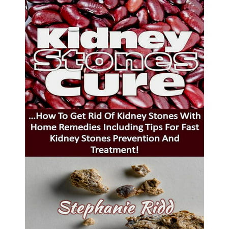 Kidney Stones Cure: How to Get Rid Of Kidney Stones with Home Remedies Including the Tips for Kidney Stones Prevention and Treatment! - (Best Treatment For Kidney Stones)