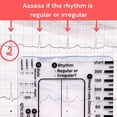 thumbnail image 4 of 5 Reglas de ECG de 7 Pasos para Interpretación de ECG/EKG, Herramienta Rápida de Análisis y Medición Cardíaca, 4 of 5