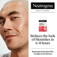 thumbnail image 3 of Neutrogena Hydrocolloid Triangle Acne Patches, Sensitive Skin, 10 Count, 3 of 11