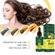 thumbnail image 2 of Aceite de jengibre para el crecimiento del cabello, sérum anticaída para hombres y mujeres, nutrición profunda para el cabello y el cuero cabelludo., 2 of 5