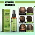 thumbnail image 2 of 2PCS Organics Rosemary Mint Scalp & Hair Strengthening Oil With Biotin & Essential Oils, Nourishing Treatment for Split Ends and Dry Scalp for All Hair Types, 2-Fluid Ounces, 2 of 8