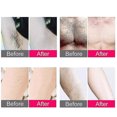 thumbnail image 4 of Depiladora láser de depilación IPL Electric Razors 300000 Flas, 4 of 5