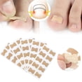 thumbnail image 1 of Pegatinas de Corrección de Uñas Encarnadas Zhivalor 50 Piezas, 1 of 1