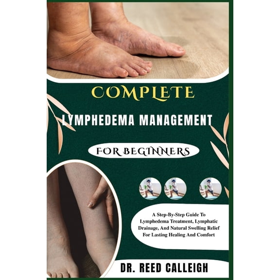 Complete Lymphedema Management for Beginners: A Step-By-Step Guide To Lymphedema Treatment, Lymphatic Drainage, And Natu, (Paperback)