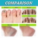 thumbnail image 3 of 3pcs Foot And Nail Spary, Natural And Powerful Foot Care, 3 of 5