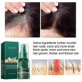 thumbnail image 3 of 3pcs Hair Growth Dense Spray Regrowth Essence Herbal Ginger Anti-loss Treatment Serum, 3 of 5