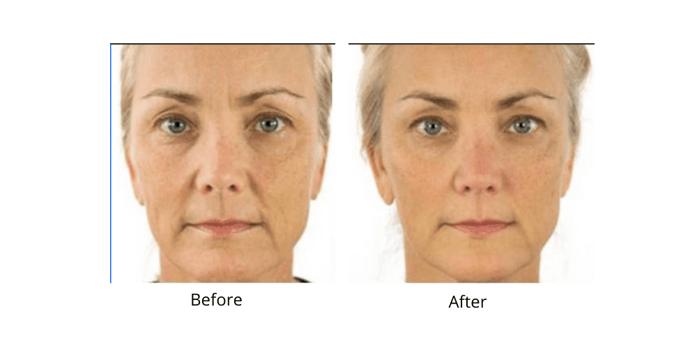 Dr. Sevinor’s NEW Genuine Facelift Solution Concentrated Serum Jumpstarts Tired Looking Skin, Diminishes Wrinkles/Lines Renews Skins Elasticity