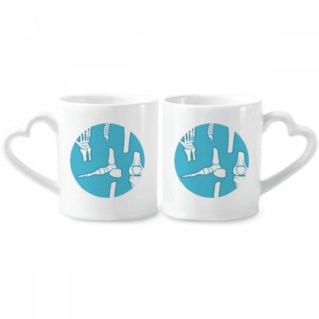 

Human Bone Blue Illustrations Cartoon Couple Porcelain Mug Set Cerac Lover Cup Heart Handle