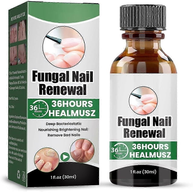 high qualityFungal Nail Serum for Toenails Extra Strong, Nail Fungus Serum for Toenail, Fungal Nail Treatment Fix Renew Damaged, Broken Nails, Nail St