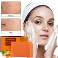 2 Pack Turmeric Soap Natural & Kojic Acid Soap For Face & Body Ultra