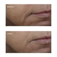 thumbnail image 3 of Vitamin C Ester Brightening Amine Face Lift by Perricone MD for Unisex - 2 oz Serum, 3 of 7