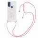 thumbnail image 3 of Funda FOXDOCK para Motorola Moto G Pure con Cuerda Ajustable, Brillo Líquido, Protección Antigolpes y Lente – Ideal para Regalo, 3 of 6