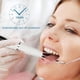 thumbnail image 4 of Limpiador ultrasónico de dientes LX-Tooth Scaler-G18 Negro, 4 of 5