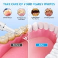 thumbnail image 2 of Kit de limpieza dental TANAVE para eliminar placa con LED, 3 modos, 2 of 7