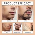thumbnail image 5 of Beard Care Solution with Jojoba, Argan, and Avocado Oils for Cleansing and Hydration to Achieve Softness and Smoothness, 5 of 5