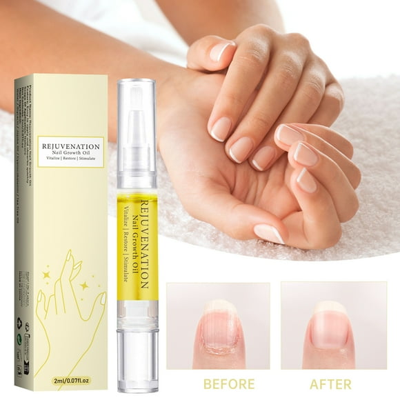 Acrylic Nails Kit Nail Growth Oil Cosmetics Nail Growth Oil Cosmetics Nail Growth Oil Nail Growth Oil Instant Nail For Peeling Breaking Thin Nails 2ml