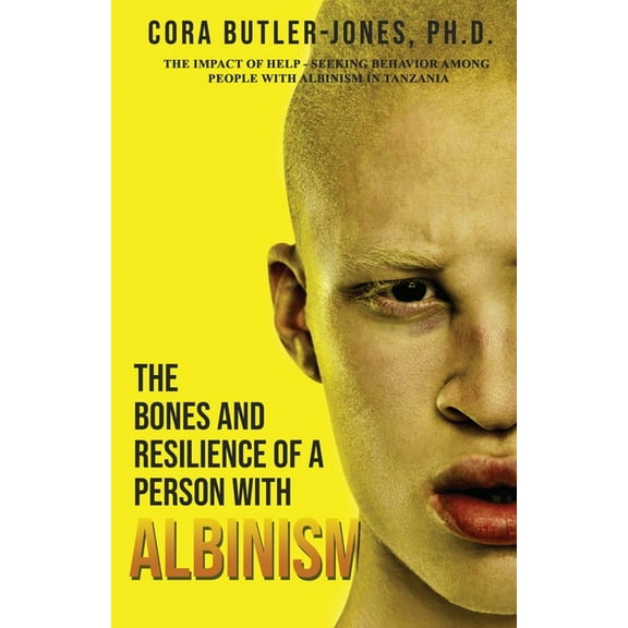 The Bones and Resilience of a Person with Albinism, (Paperback)