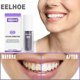 thumbnail image 3 of Gel Portátil para Ning Dientes Herramienta Correctora Color Eficaz Blanco, 3 of 9