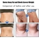 thumbnail image 3 of Neck Acupoints Lymphvity Massage Device, Lymphvity Massager, Neck Acupoints Lymphvity Massager Device, 3 of 5