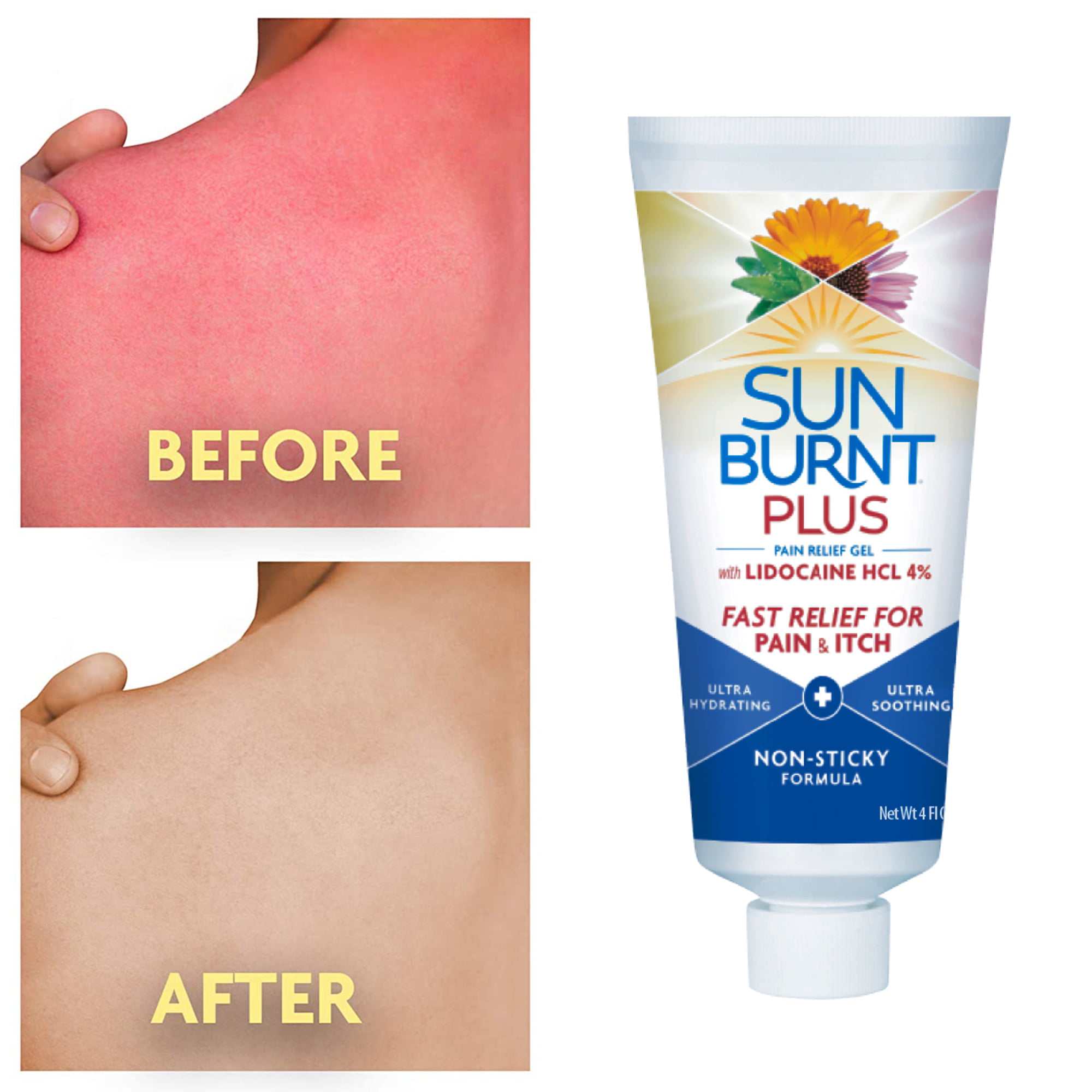 Making Sunburn Relief Paste (DIY Saturday Episode 22 ) 