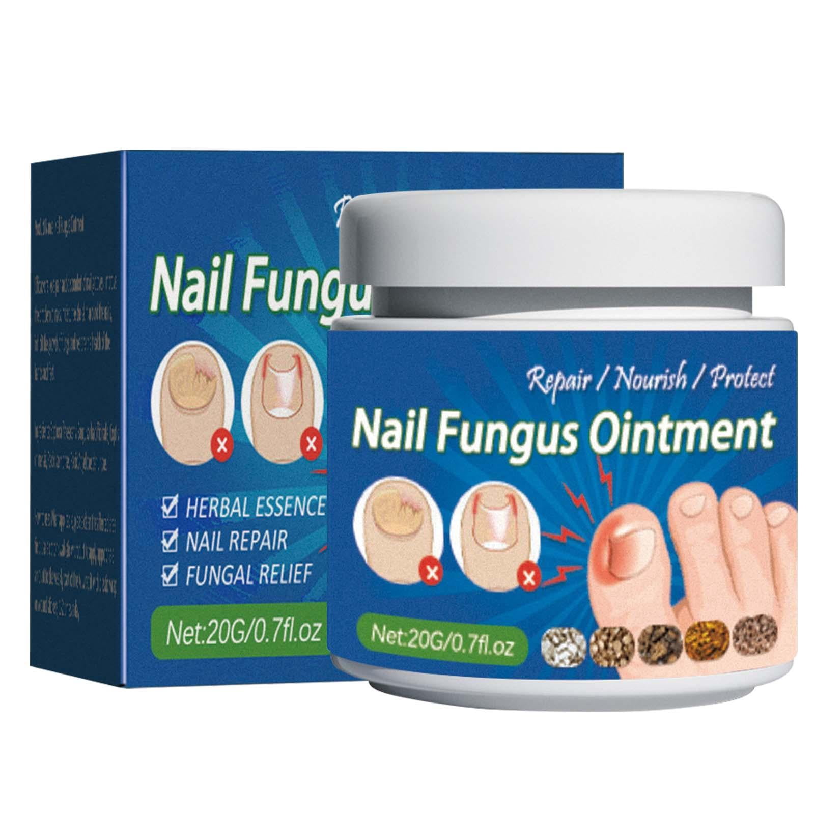 Gentle Toe Nail Cream Paronychia Repair Ointment 20g Natural Feet Care