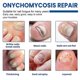 thumbnail image 2 of Toenail Repair Patch Grey Nails Torn Toenails Soft Nails Repair Moisturizing Nai, 2 of 4