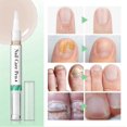 thumbnail image 3 of 1-3pcs Nail Care PenThe Original, Nail Fungus Pen Austria, Nail Care Pen Cosmetic Care for Nail Fungal Infection, 3 of 5