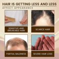 thumbnail image 3 of Thickening hair essence nourishes hair roots, strengthens hair, prevents hair loss, repairs damaged hair, thickens hair essence 30ml, 3 of 4