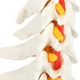 thumbnail image 4 of Axis Scientific Cervical Spine Model with Spinal Nerves and Arteries | Vertebrae Model Shows Bony Landmarks of the Cervical Spine and Has Occipital Bone | Comes on Base | 3-Year Warranty, 4 of 13
