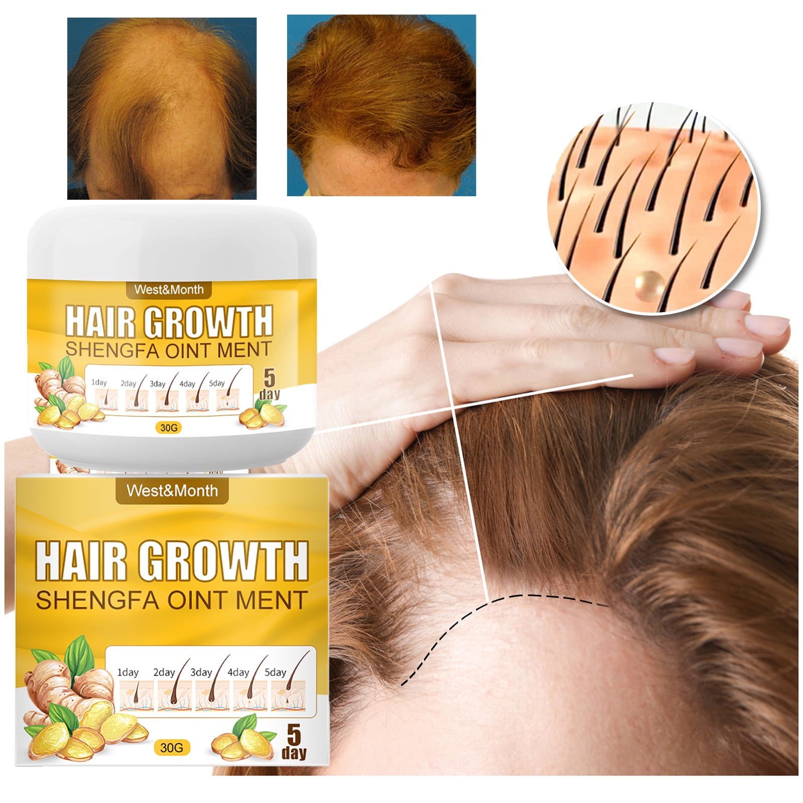 WOXINDA Ginger Hair Growth Essential Shampoo,Ginger Stop Hair Loss Hair  Regrowth,Thicker,Longer Hair Regrowth Treatments 30g 
