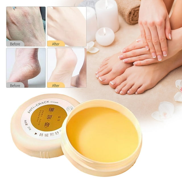 Teissuly Cracked Skin Repair Cream, Winter Crack & Hand Foot Cream, Foot Cream For Dry Feet For Daily Care, Heel Cracks, Dry Cracks, Frost Bent 20g Teissuly WER202401227011