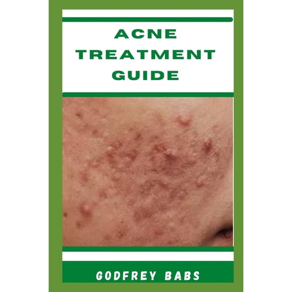 Acne Treatment Guide: Manage acne with ease (Paperback)