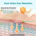 thumbnail image 4 of Dimora UPF50+ Silicone Scar Sheets - UV Protection Medical Grade Silicone Scar Tape for C-Section, Surgery, Keloid & Burn Scars - Reusable, Breathable & Flexible (1.6” x 79” Roll), 4 of 11
