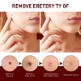 thumbnail image 3 of Tags & Moles Remover, WipeOff Tags & Moles Remover, WipeOff Remover 3ML, 3 of 4