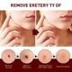 thumbnail image 3 of Eliminador de etiquetas y lunares, WipeOff Eliminador de etiquetas y lunares, WipeOff Remover 3ML, 3 of 8