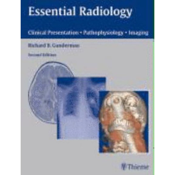 Pre-Owned Essential Radiology (Paperback) 3131104724 9783131104724