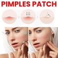 thumbnail image 3 of Parches para espinillas en la cara Parches hidrocoloides para el acné Versátiles y lindos cubre espinillas con forma de estrella Pegatinas para manchas Parches suaves y no irritantes 5 colores 3 tama, 3 of 5