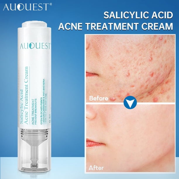 Crema facial hidratante antiedad, aceite de caballo para eliminar arrugas, tensar la piel, aclarar los poros, desvanecer los ojos y el cuello, líneas finas, 30ml"Horse Oil Cream" Fivean LED