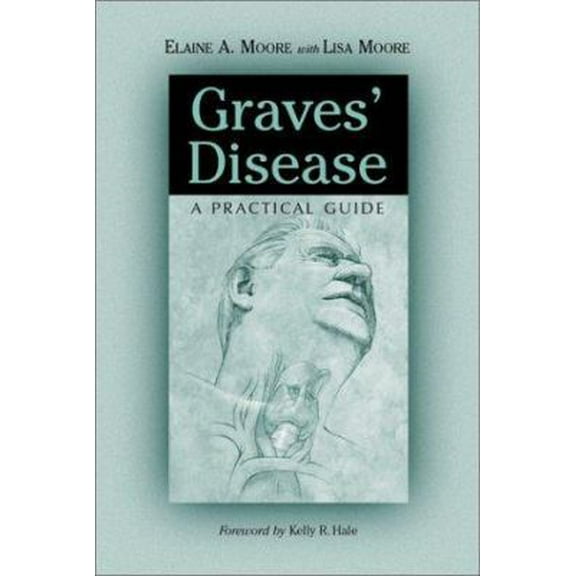 Pre-Owned Graves' Disease: A Practical Guide (Paperback) 0786410116 9780786410118