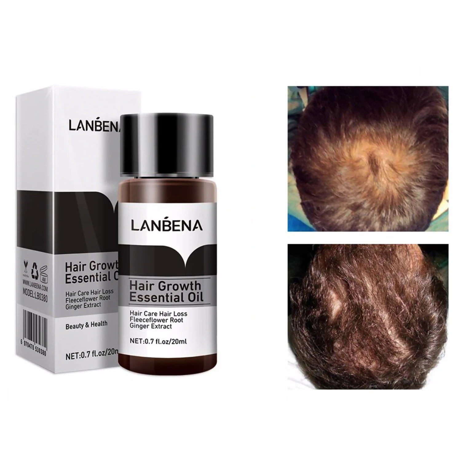 Essential Oil for Hair Growth and Hair Loss Treatment for Men and Women