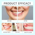 thumbnail image 4 of Tooth Whitening Cleansing Powder Fast Teeth Cleaning Whitening Powder for Adults Teens, 4 of 5