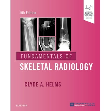 Fundamentals of Skeletal Radiology
