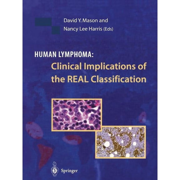 Human Lymphoma: Clinical Implications of the Real Classification, (Paperback)