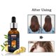 thumbnail image 1 of Solución Nutritiva para El Cabello Hot6sl con Ajo 50 ml, 1 of 7