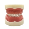 thumbnail image 1 of CHUANK Typodont Child Teeth Model  with 24pcs Removable Teeth  Compatible with Kilgore Nissin for Teaching  Study, 1 of 1