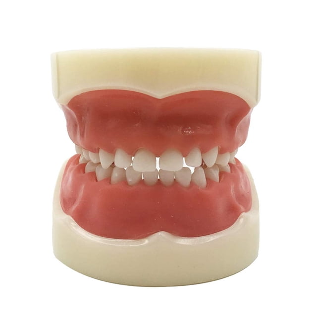 CHUANK Typodont Child Teeth Model with 24pcs Removable Teeth Compatible with Kilgore Nissin for Teaching Study