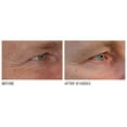 thumbnail image 6 of ($159 Value) Dr. Dennis Gross SpectraLite EyeCare Pro LED Device, 6 of 7